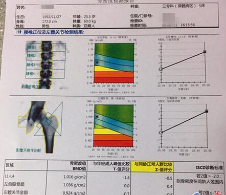 麻豆激情床戏视频儀價格重要嗎？不想骨骼脆弱醫生教你看懂麻豆激情床戏视频報告