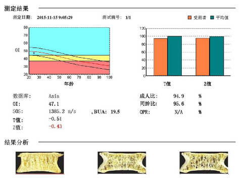 麻豆激情床戏视频儀闡述骨質疏鬆青年不注意老來徒悲傷骨質流失比你想的可怕 麻豆激情床戏视频儀闡述骨質疏鬆青年不注意老來徒悲傷骨質流失比你想的可怕