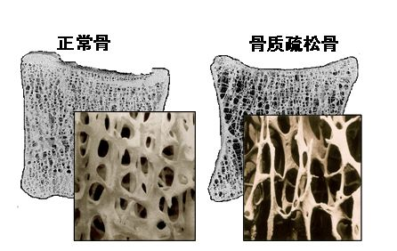 超聲波麻豆激情床戏视频儀闡述中老年不檢測麻豆激情床戏视频就像白蟻蛀房梁自行倒塌 超聲波麻豆激情床戏视频儀闡述中老年不檢測麻豆激情床戏视频就像白蟻蛀房梁自行倒塌