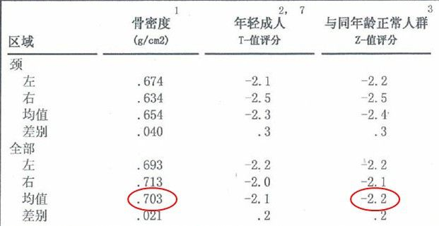 麻豆激情床戏视频儀生產廠家根據T值和Z值的變化來判斷骨骼健康的狀況 麻豆激情床戏视频儀生產廠家根據T值和Z值的變化來判斷骨骼健康的狀況