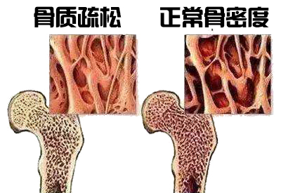 麻豆激情床戏视频儀生產廠家介紹其實各個年齡階段麻豆激情床戏视频不同最佳檢測年是多少你知道嗎？