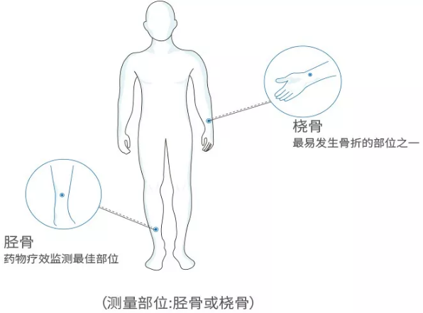 超聲波麻豆激情床戏视频分析儀廠家 國產老年人超聲波麻豆激情床戏视频分析儀廠家