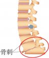 吉林長春|亚洲国产精品麻豆超聲麻豆激情床戏视频儀廠家品牌分享：為什麽現在的年輕人也存在骨刺增生?