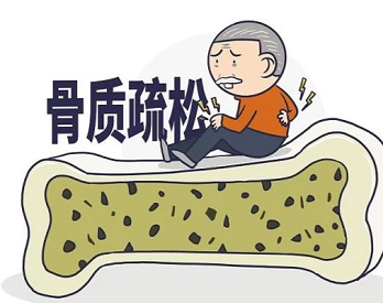體檢的便攜式麻豆激情床戏视频檢測儀檢查能不能精準查出骨質疏鬆呢？